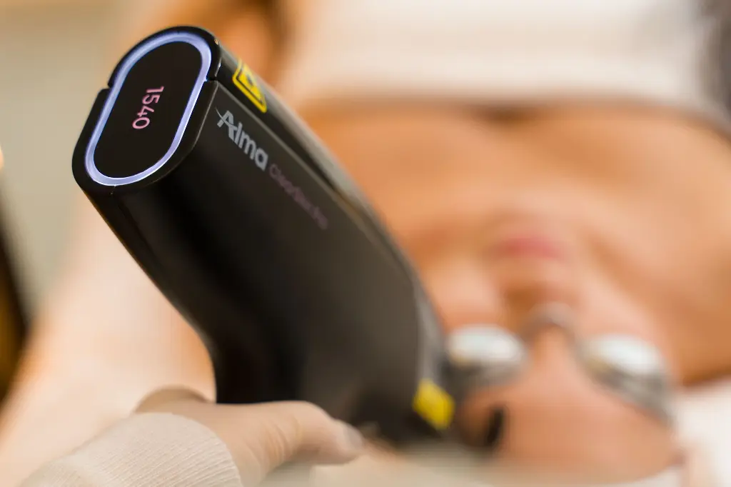 Intelligent 標靶性革命性雙技術激光療程