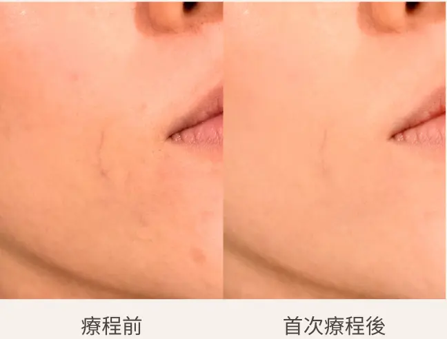 Screenshot 2026-04-16 at 10.27.03 PM.webp