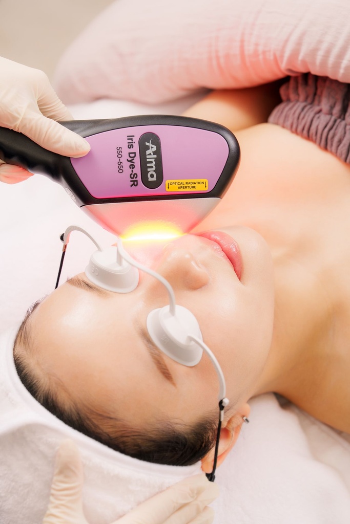 極光淨肌 ‧ Alma Harmony (面部)